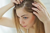 shampoing antipelliculaire